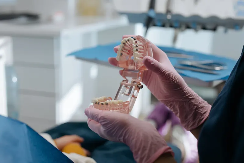 Modelo de estudio dental sobre la mesa de trabajo
